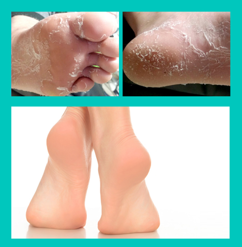 MISSHA Wonder Foot Peeling Mask – Intenzivní peelingová maska na nohy