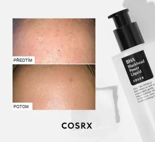 COSRX BHA Blackhead Power Liquid - Exfoliační péče na ucpané póry a černé tečky