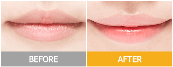Pred a po použitie balzamu na pery A´pieu Honey & Milk Lip Balm